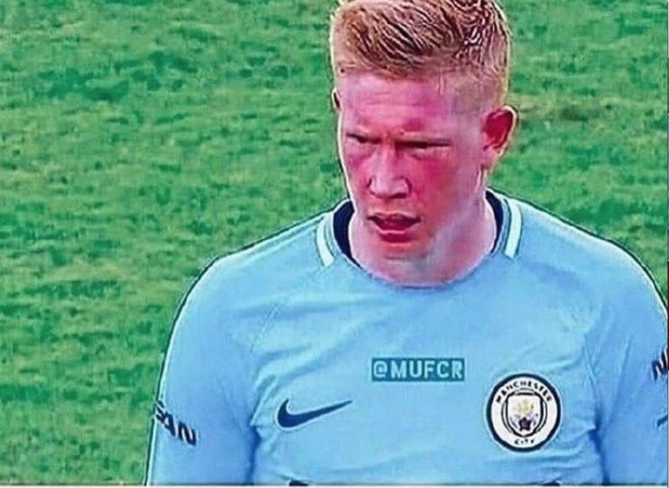 TAA再遭伤情打击2025报销：后防问题困扰阿隆索，解决不好就下课